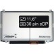 Screen for the Asus E202SA laptop LCD 11,6“ 30pin eDP HD LED Slim - Glossy